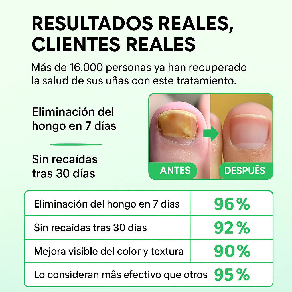 Aceite Anti-Hongos Natural – Uñas sanas y fuertes