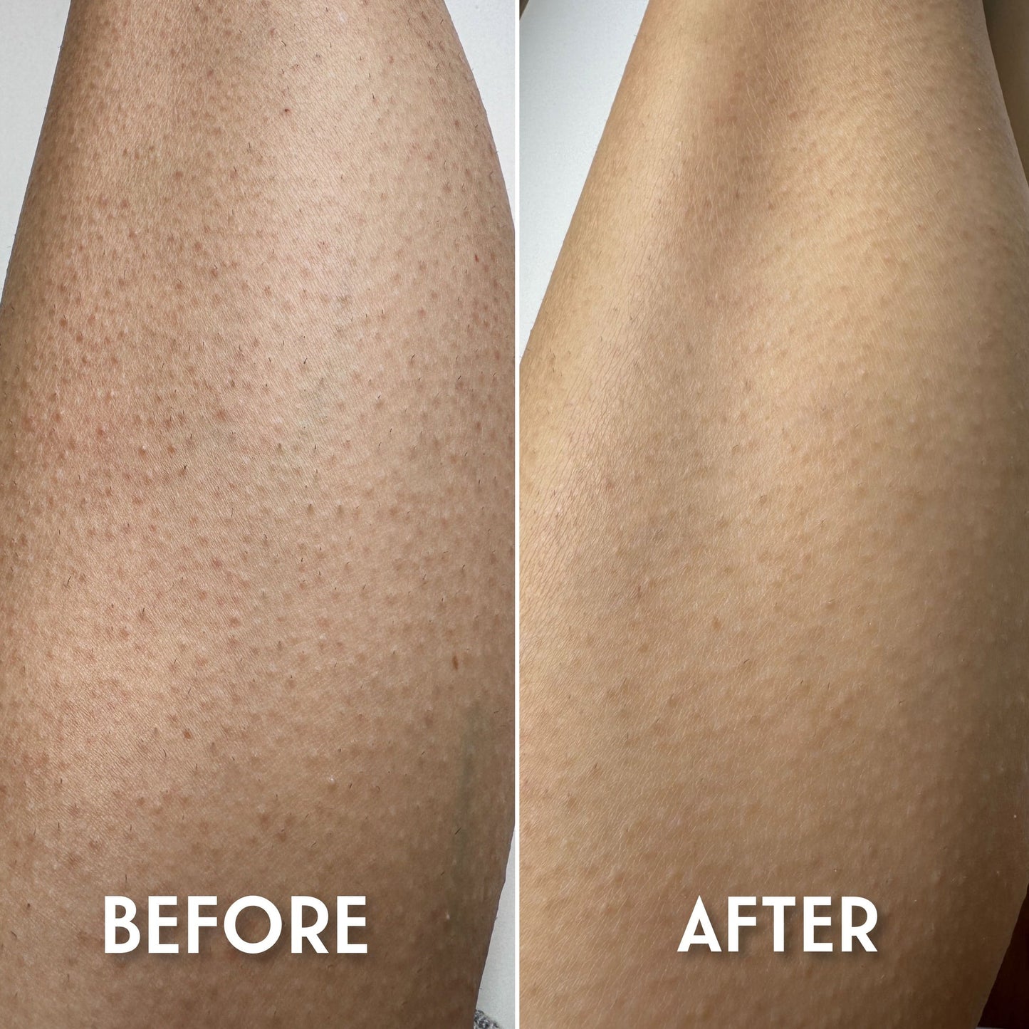 Guante Exfoliante: di adiós a la piel áspera sin químicos