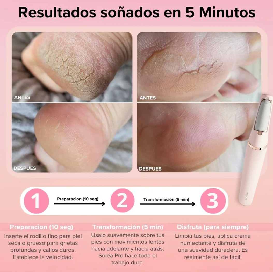 Removedor de Callos Eléctrico