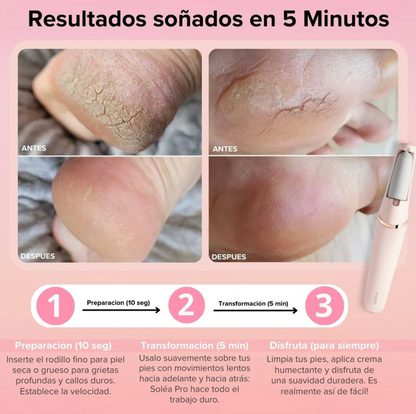 Removedor de Callos Eléctrico